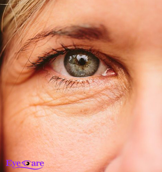 پیر چشمی از چه سنی شروع می شود؟‌